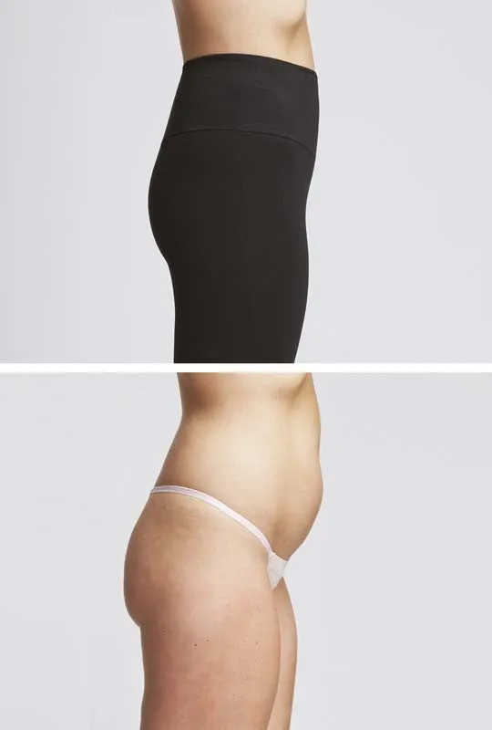 Extra Strong Compression Tummy Control Leggings with Egyptian Cotton Black